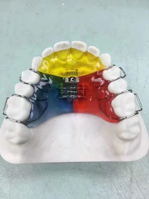 Nance / Hyrax / Rapid Palatal Expander Gece Muhafızı Uzay Koruyucusu OEM Kullanımı Güvenli
