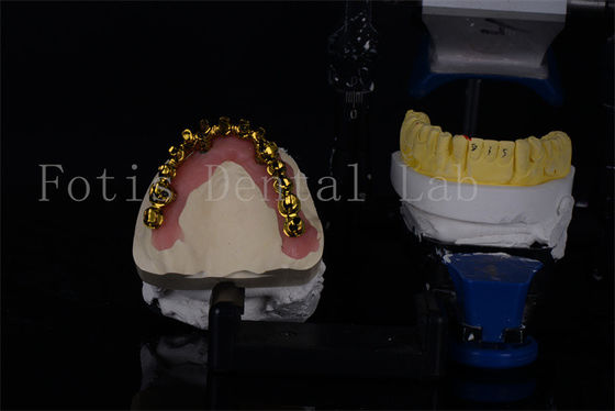 Doğal görünümlü gülümsemeler için uygun fiyatlı Titanyum / Zirkonya tüm 4 diş implantı