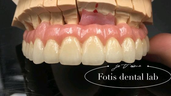 Güvenilir Restorasyon PFM Diş Taçları Porselen Metal Taçlara Doldurulmuş Özel