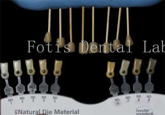 Dayanıklı 0.3-0.5mm Kalınlıklı Diş Laboratuvarı Finerleri Dişler için Sahte Finerler