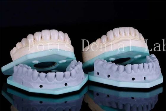 lekeye dayanıklı diş kaplamaları diş kliniği kaplamaları 0.3mm-0.5mm kalınlığı