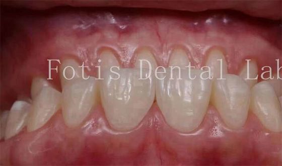 Özel Doğal Görünümlü Yapışkanlar 0.3mm-0.5mm Kalınlığı