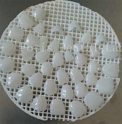 Yumuşak yüzey dokusu kozmetik diş kaplamaları ile cilalama oyununuzu geliştirin
