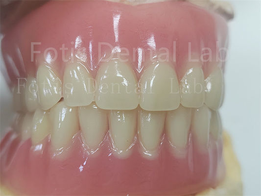 Rahatlık Tam Acrylic Diş Protezi Kesin Diş Protezi