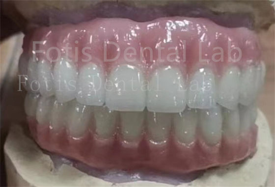 Kesinlikle Uygun Ivoclar Dişleri Akrilik Tam Diş Dişleri leke karşıtı