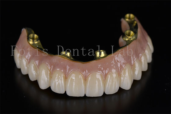 Profesyonel ve Etkili Tedavi Diş Sorunları İçin 6 implant