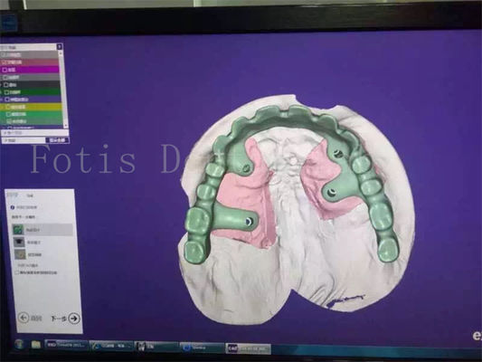 Diş Restorasyonu Diş Dentüsü Tasarım Stüdyosu Sizin Memnuniyetiniz İçin Uzmanca Yapıldı