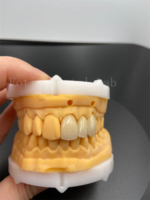 Precision Fit Digital Crowns Implant Dentrues ile Uyumlu E-posta İletişim Modu