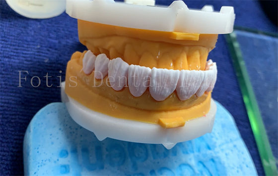 Gelişmiş Dijital Diş Tacı Dentrue Tacı FDA/ISO/CE Sertifikalı