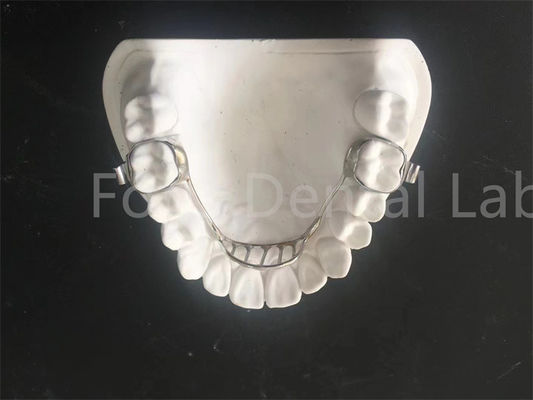 Özelleştirilebilir Genişletici Sahip Palatal Genişletici Sahip Kolay Bakım