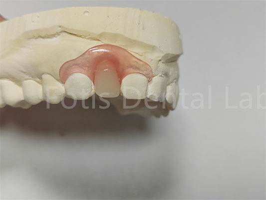 Flexible Pink/Transparent Valspar Dental Partials kolay ayarlama