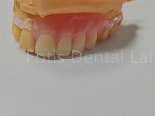 FDA/ISO Sertifikasyonu TCS Valplast Esnek Diş Dişleri Temizlenmesi Kolay Düzenlenebilir