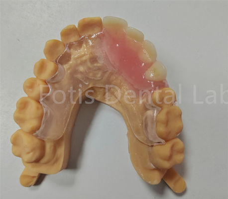 Hipoalerjenik Rahatlık Uyumlu Esnek Valplast Kısmi TCS Diş Cihazı