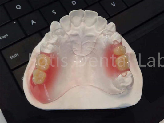 Esnek TCS Valplast Diş Aletleri Konforlu Dayanıklı Tasarım