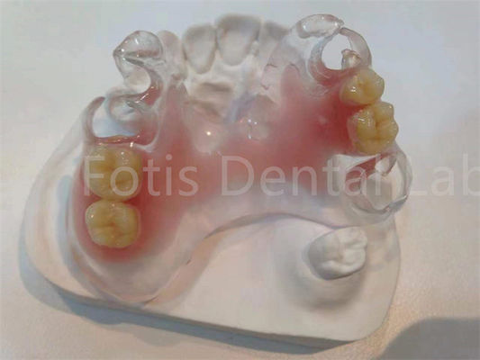 Uzun süreli rahatlık için hipoalerjenik leke direnci TCS Valplast diş protezleri