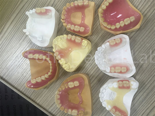 Esnek TCS Valplast Kaldırılabilir Kısmi Diş Dişleri