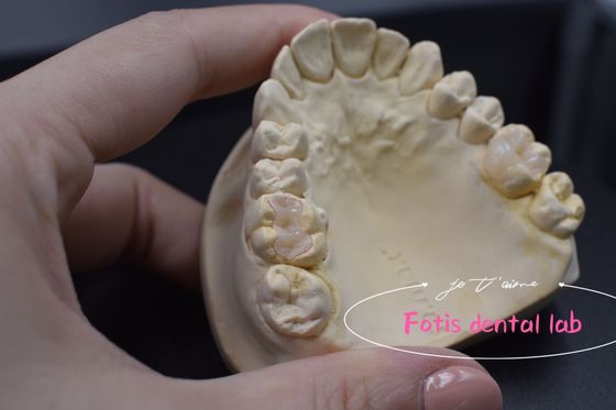 Özelleştirilebilir Modern Diş Inlay ve Onlay Çok yönlü Uygulamalar