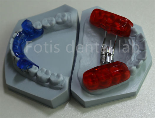 Etkili Diş Tutma Dental Laboratuvar Diş Genişletme Ortodontik Uzay Koruyucusu