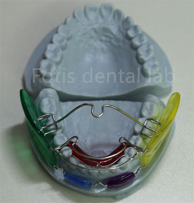 Diş Laboratuvarı Ortodontik Palatal Genişletici Dişleri Hizalamak İçin Çok yönlü ve Etkili