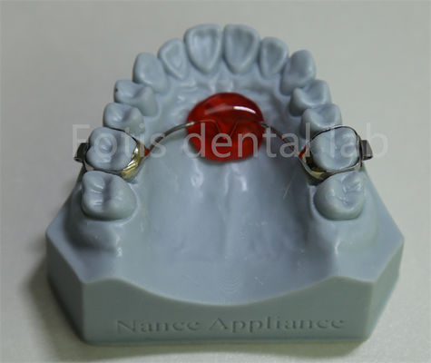 Diş Laboratuvarı Ortodontik Palatal Genişletici Ucuz ve Çoğu Tedaviyle Uyumludur