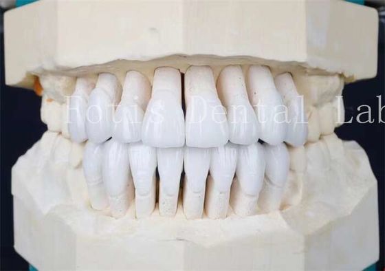 Yapışkan Bağlayıcı Çimento ve Yüksek Güçlü Sentetik Laminat Finerler Mükemmel Çiftlik