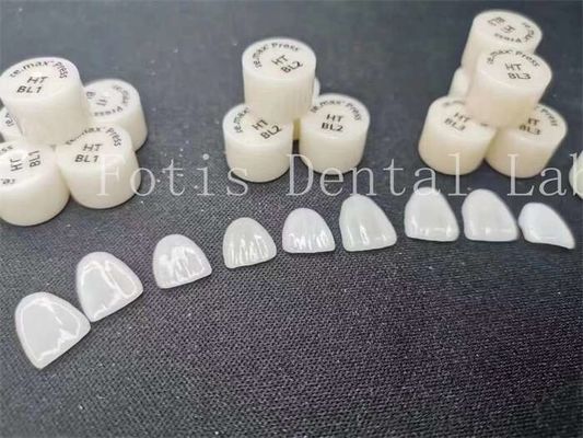 Özellik Dental Laboratuvar Laminat Finerler Yüksek leke Direnci ve Güç